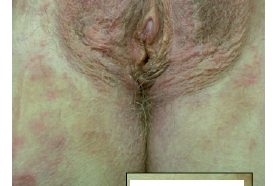 187 – Pathologie 3