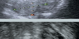 Capture d’écran 2017-06-15 à 16.38.08