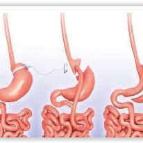 Screen Shot 06-13-17 at 05.20 PM 001