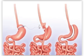 Screen Shot 06-13-17 at 05.20 PM 001