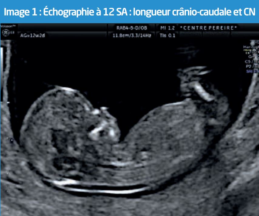 Ventre De Mesure De Sourire De Périmètre De Femme Enceinte Avec La